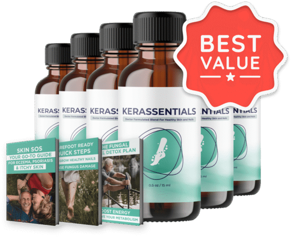 Kerassentials