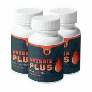 Arteris Plus