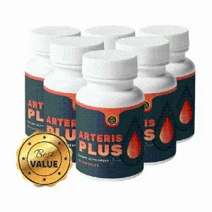 Arteris Plus